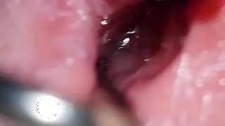 penis broadcasting situation